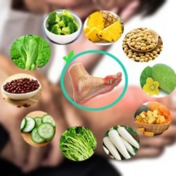Người bệnh gút nên và không nên dùng những thực phẩm nào?