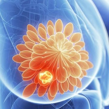 Kết quả nghiên cứu Y học, Hoa Kỳ chứng minh: Vai trò của GABA trong việc hỗ trợ điều trị ung thư vú